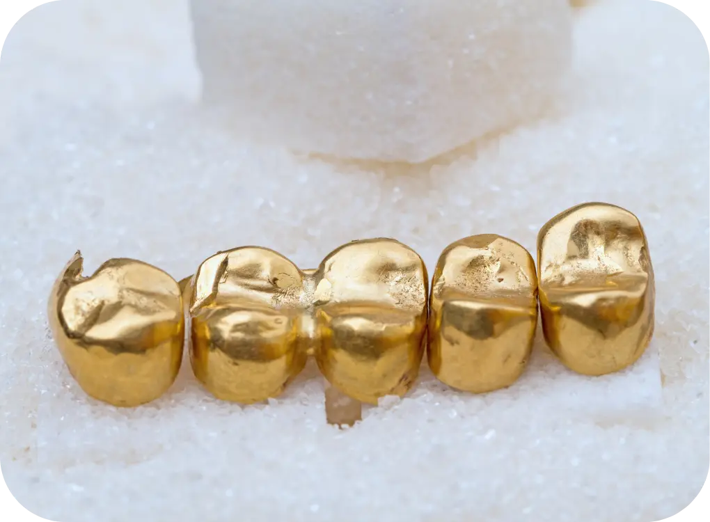 Zahngold